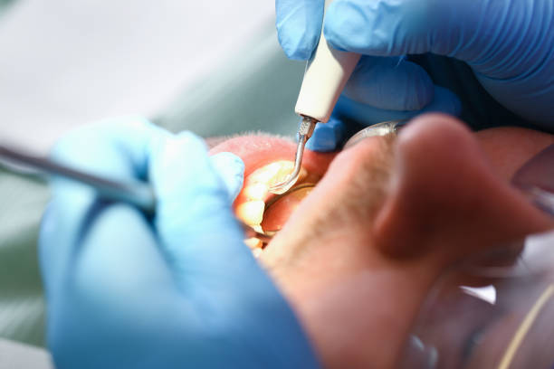 Best Knocked-Out Tooth Emergency  in Mascoutah, IL