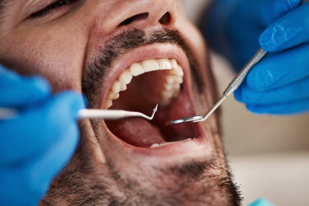 Best Dentist for Tooth Abscess  in Mascoutah, IL